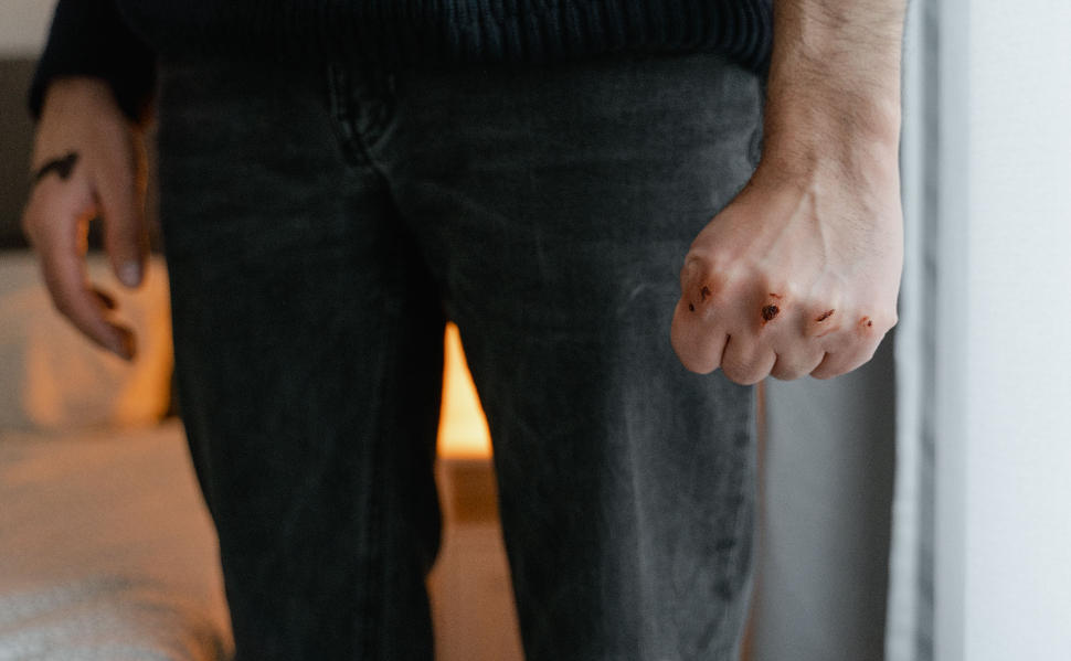 Close-up of a person with a clenched fist and visible injuries on their knuckles, illustrating physical violence.